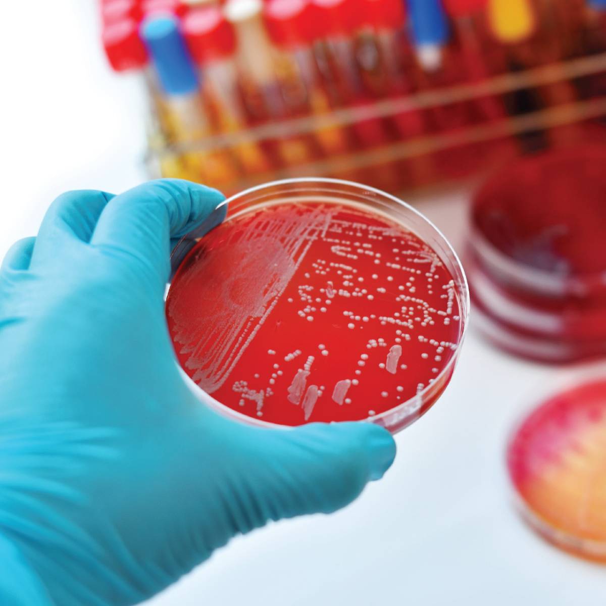 Microbial Limit Test