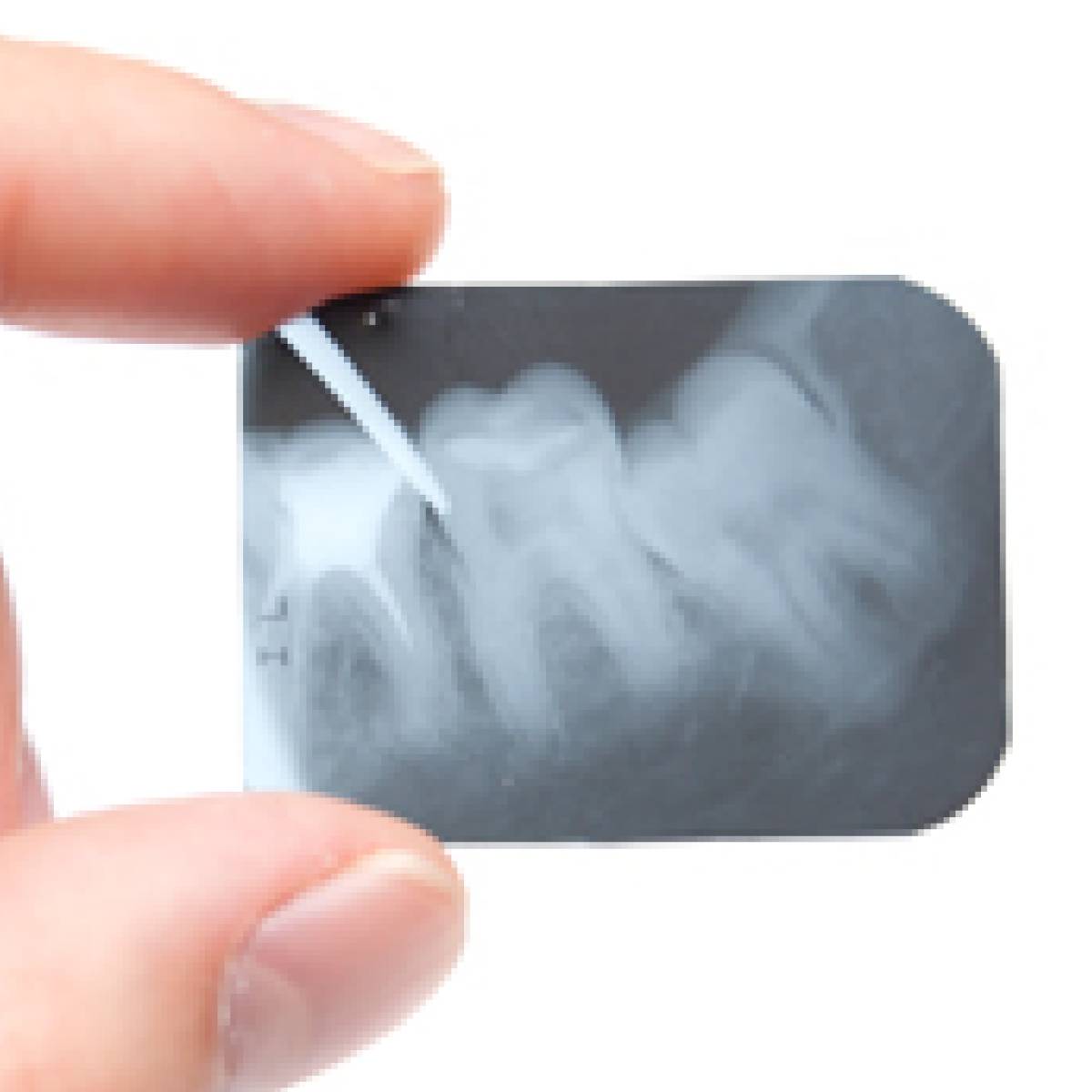 All About Dental Xray Films