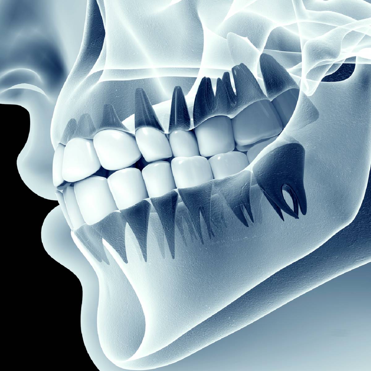 Dental Film Processing