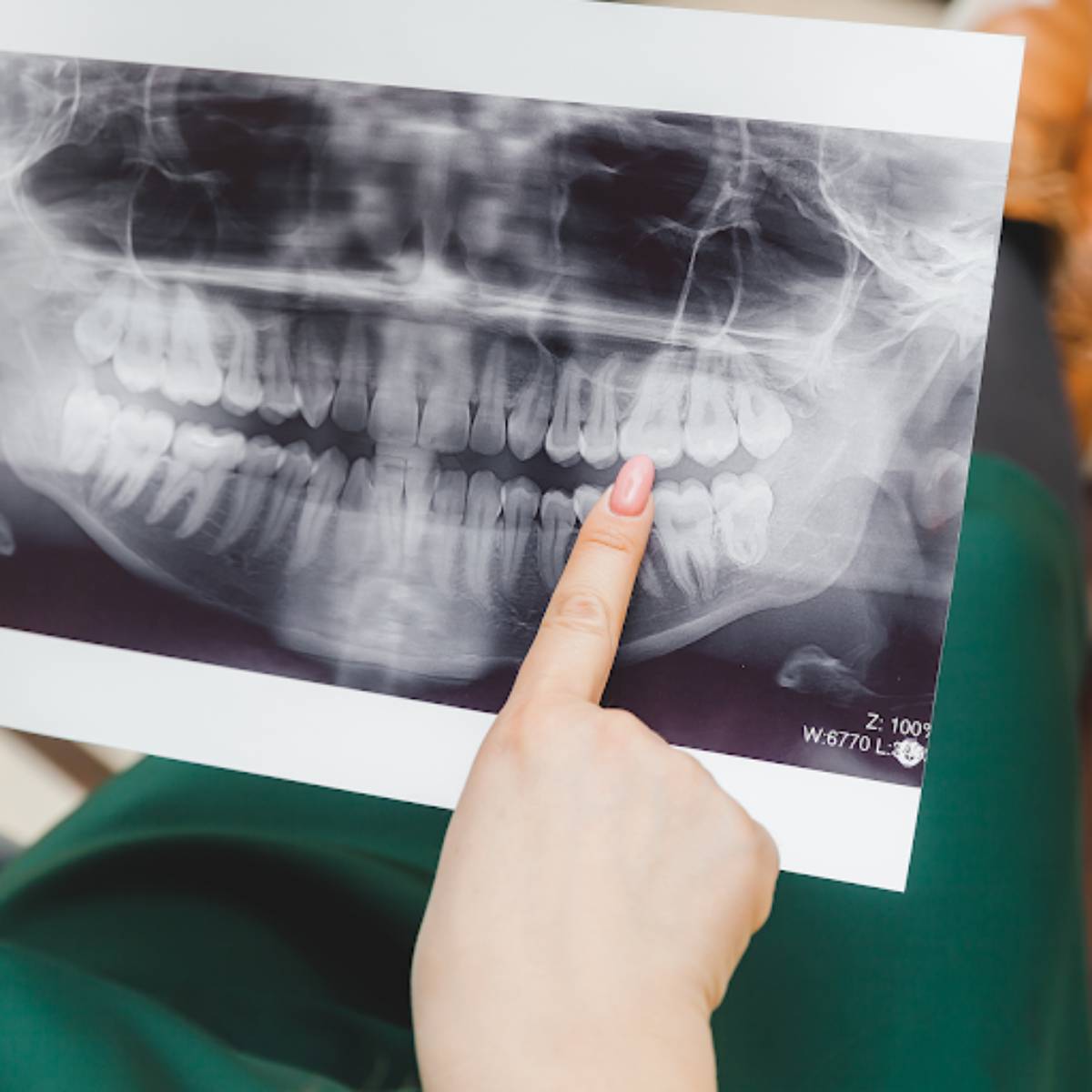 Dental Xray Image Characteristics